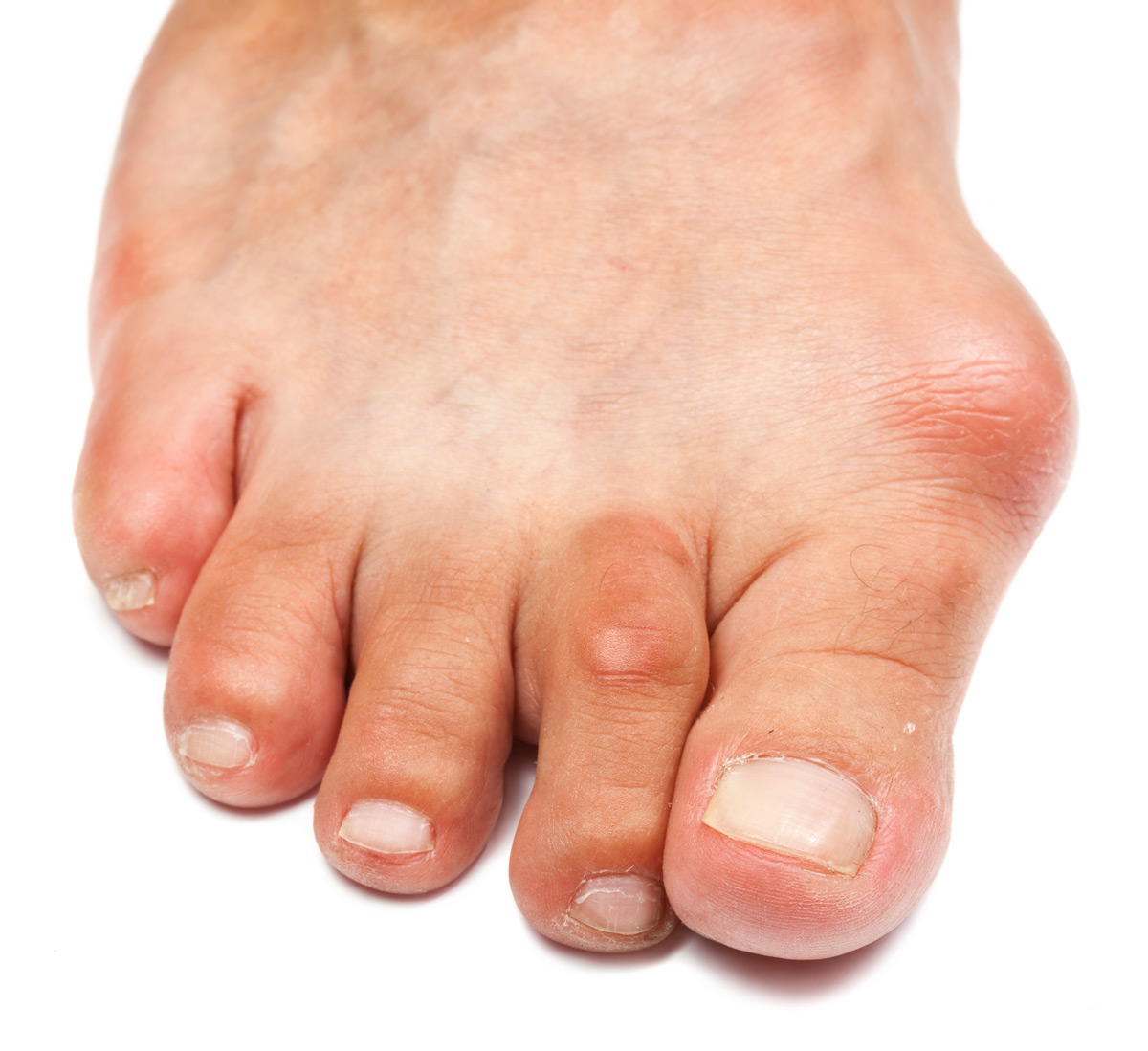 Foot Health: Common Issues and How to Manage Them