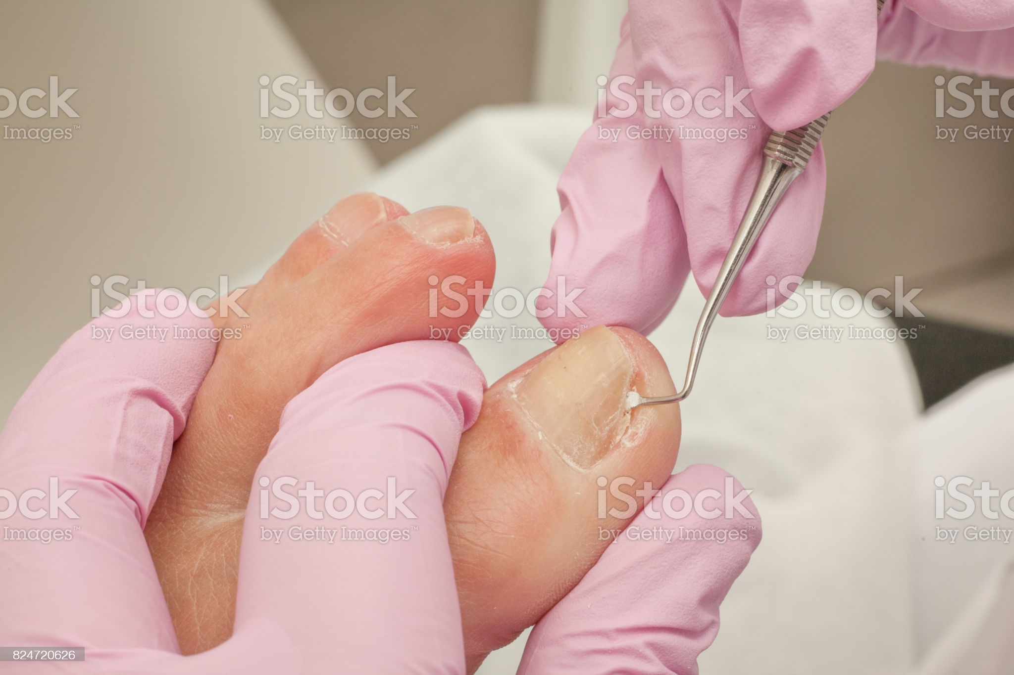 Toenail Conditions - Relieve Foot Pain & Leg Pain