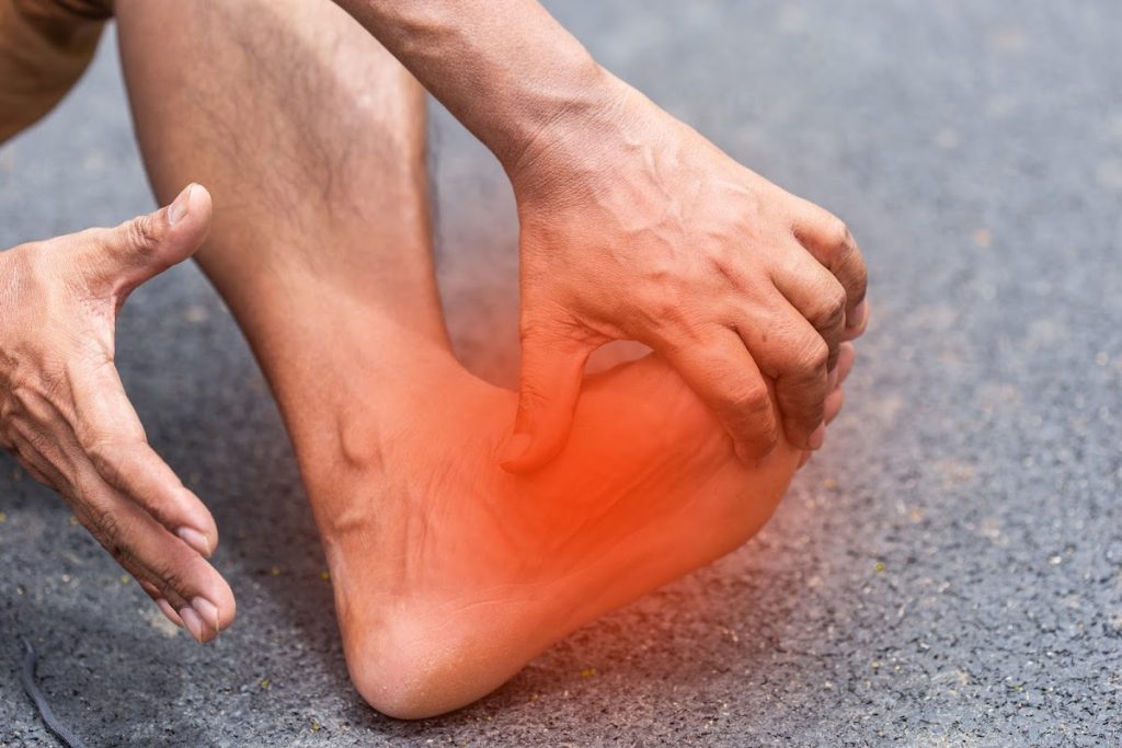 Close-up Of A Man's Ankle Showing Symptoms Of Pain From Plantar Fasciitis.